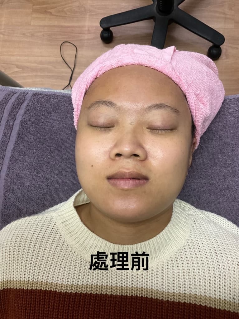 高雄做臉推薦 西林專業護膚美容中心3