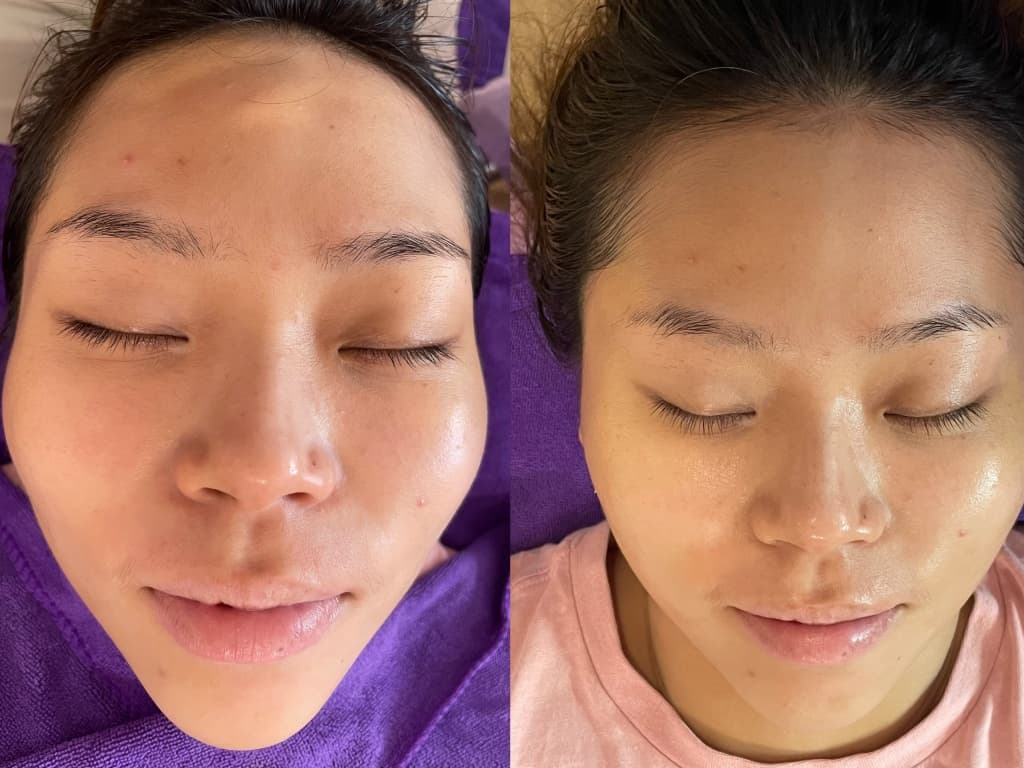 嘉義做臉推薦 芙蕾亞美妍 Freya Beauty3