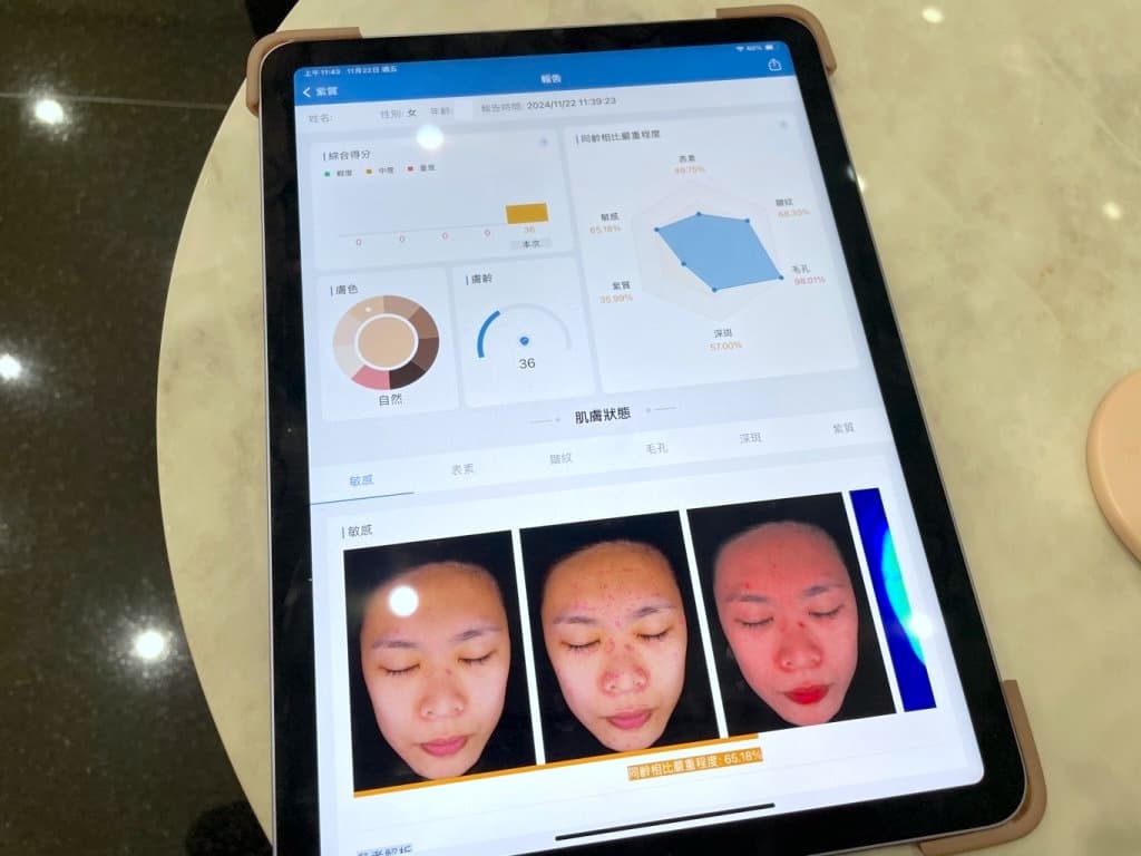 高雄皮秒雷射推薦 悅真醫美診所2