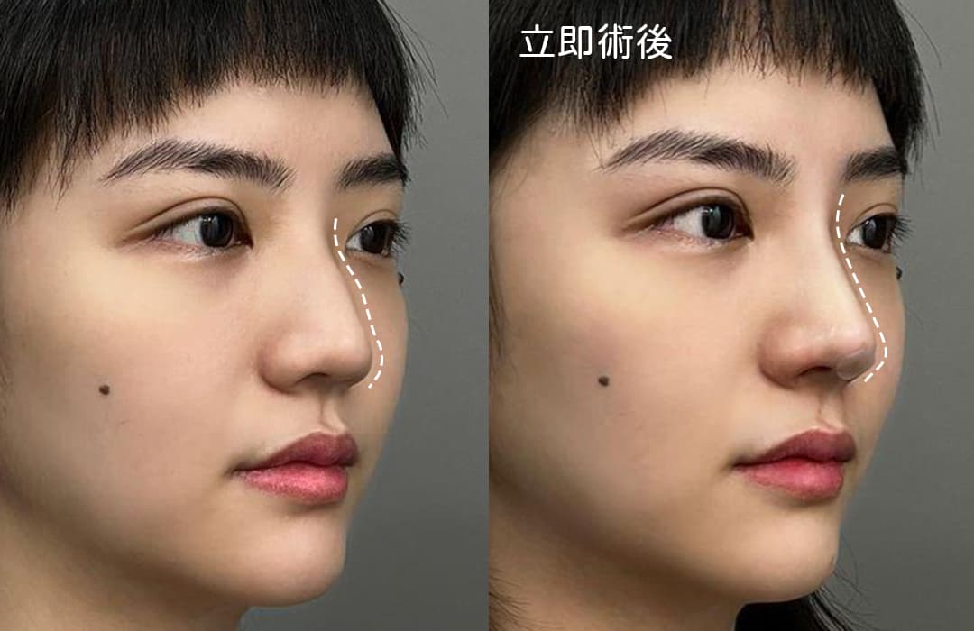 從肌膚到輪廓全面提升