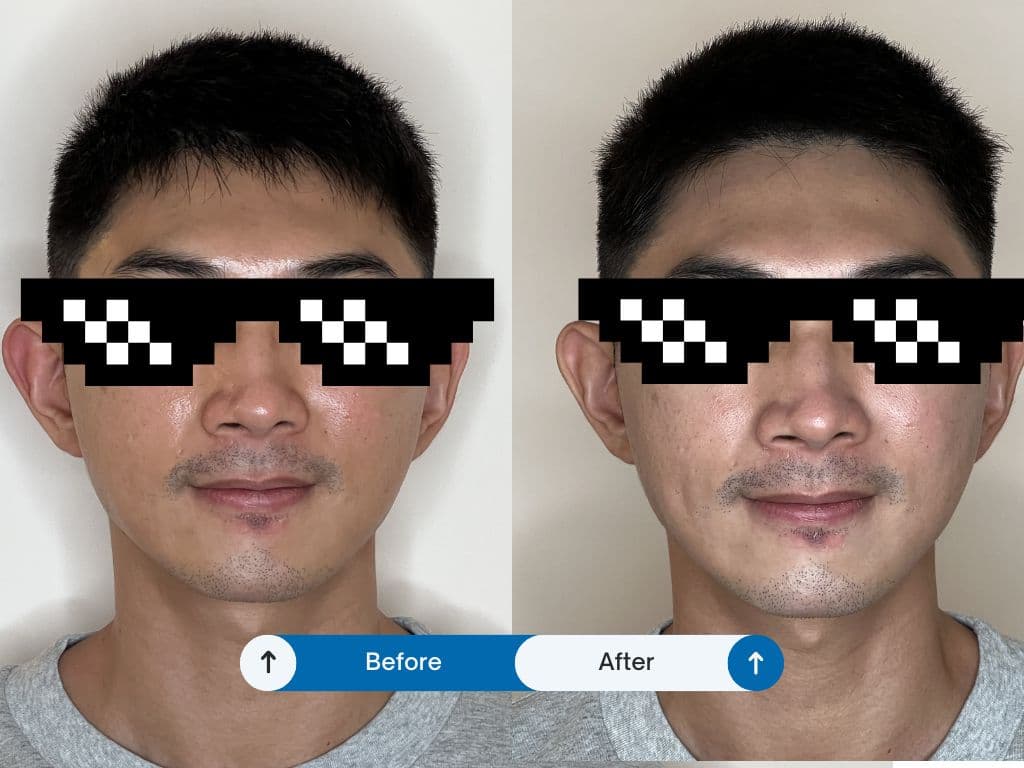 Visibly Brighter, Renewed Skin