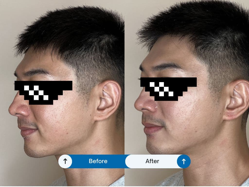 A dramatic upgrade to your profile, with noticeably clearer, brighter skin.