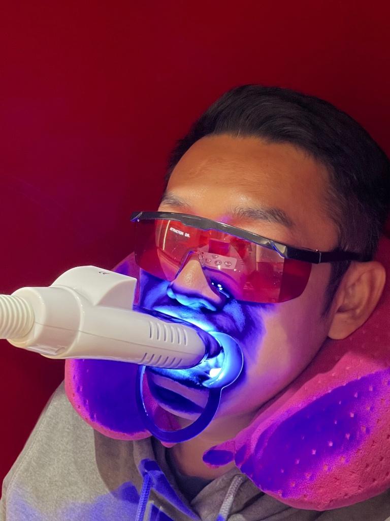 台中牙齒美白推薦 Attraction Dr.4