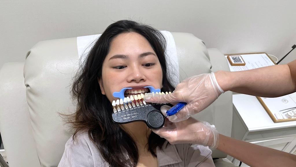 BRIGHTEETH Teeth Whitening Aesthetics Center