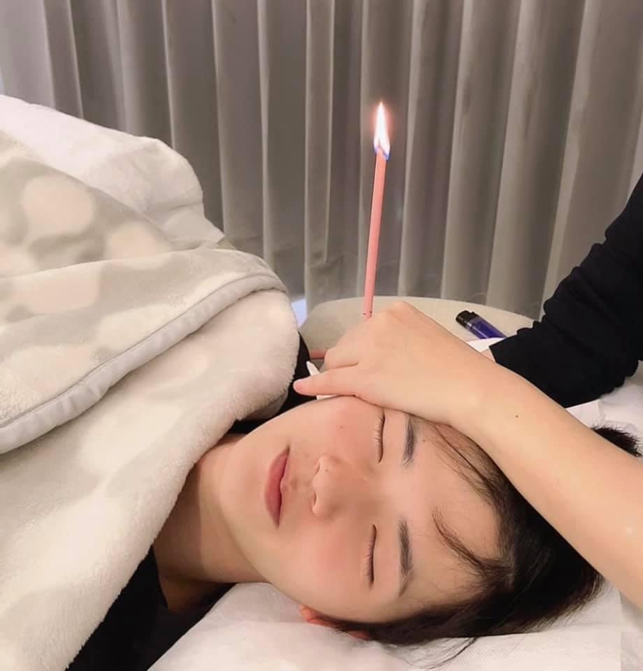 台北耳燭推薦 佳采耳美容