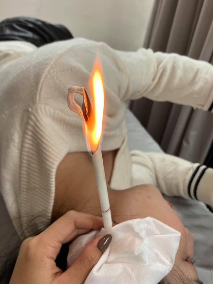 高雄耳燭推薦 Ya.Maear耳燭