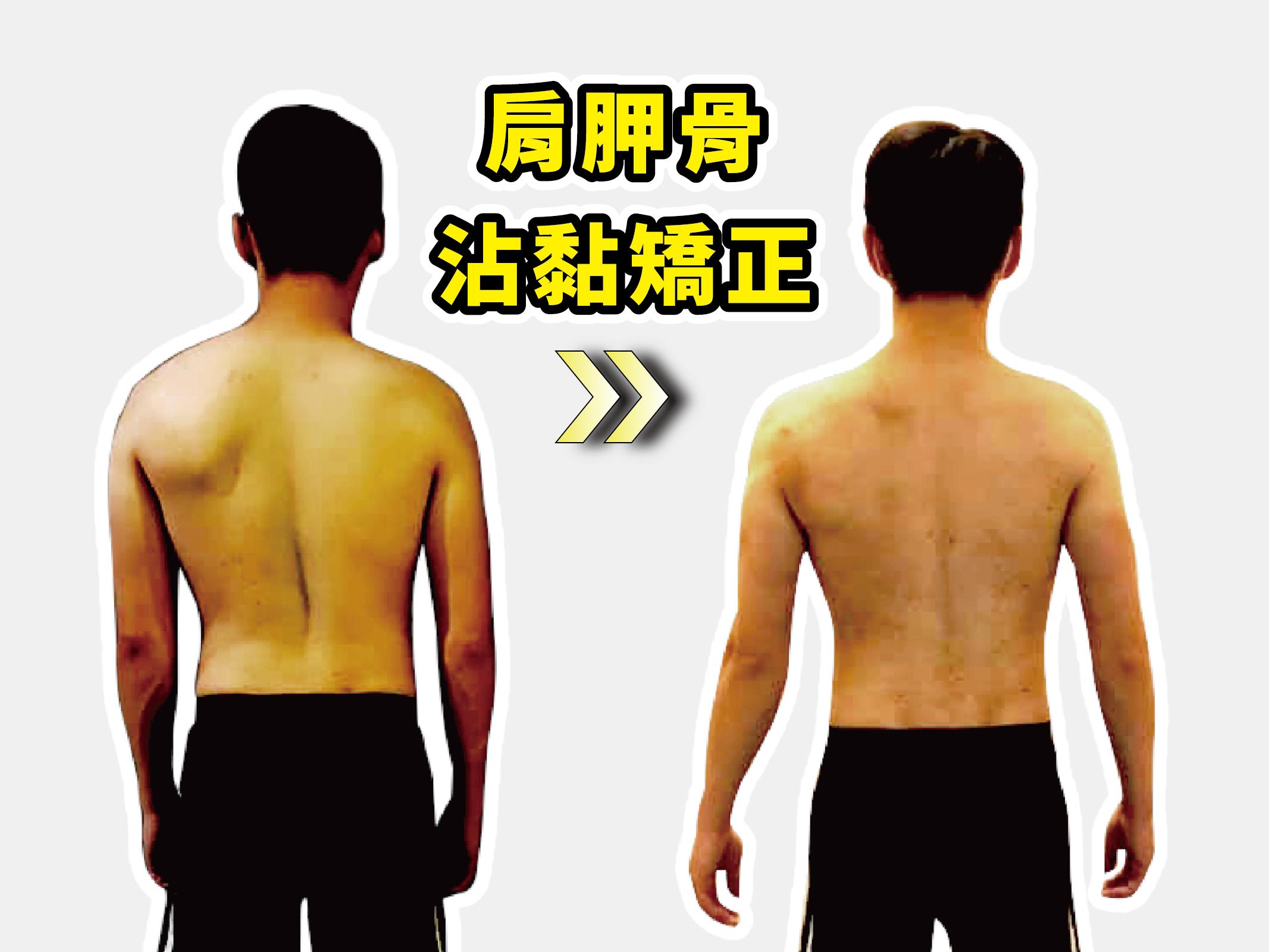 特殊トレーニング対象者:負傷者・病気の方