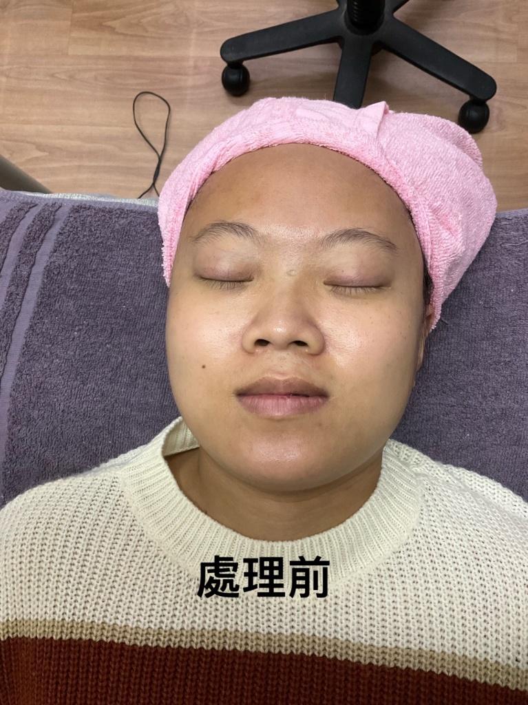 高雄做臉推薦 西林專業護膚美容中心3