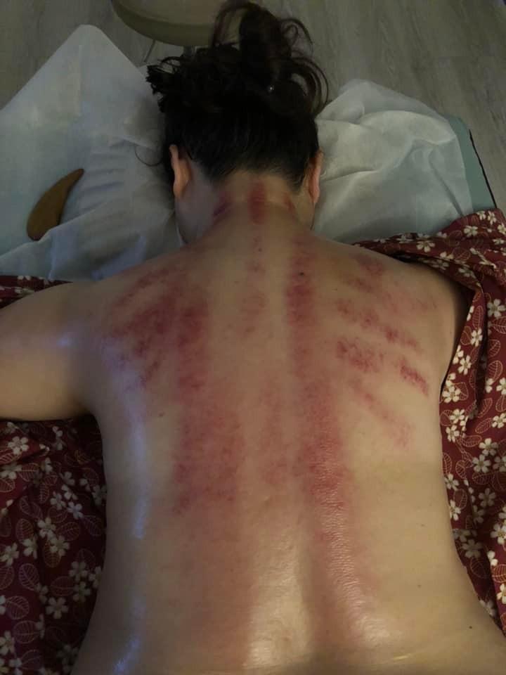 台中刮痧 森冶 Spa