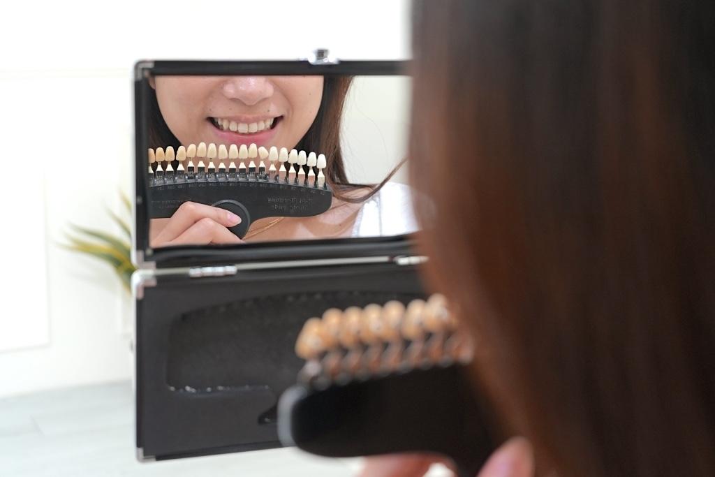 BRIGHTEETH 타이베이점 평가|40분 만에 효과! 치과 의사가 직접 교육한 동취 치아 미백 전문 매장