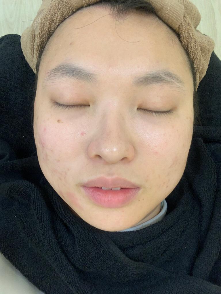 台南做臉推薦 沐夏 Luna Skin3