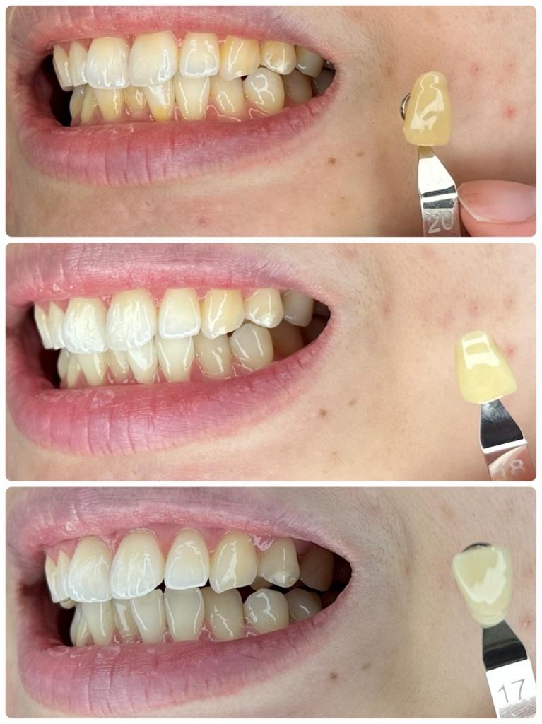 White Smile 牙齒淨白美學中心 照片