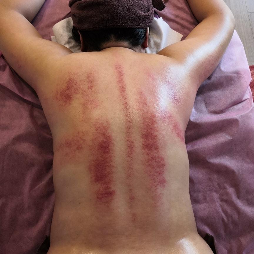高雄刮痧推薦 福心手藝按摩