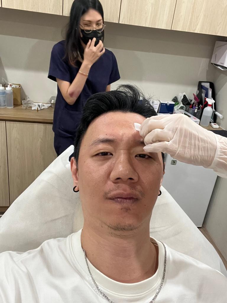台中肉毒推薦 許惠翔美學診所2