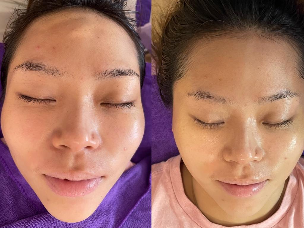 嘉義做臉推薦 芙蕾亞美妍 Freya Beauty3