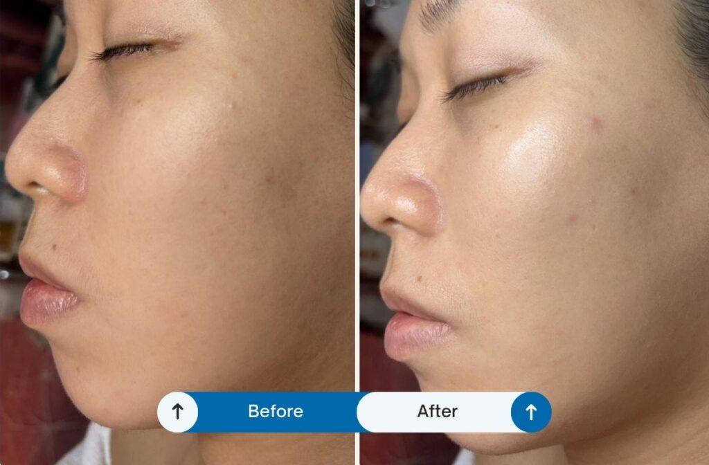 台北做臉推薦 光馨妍美顏美學4