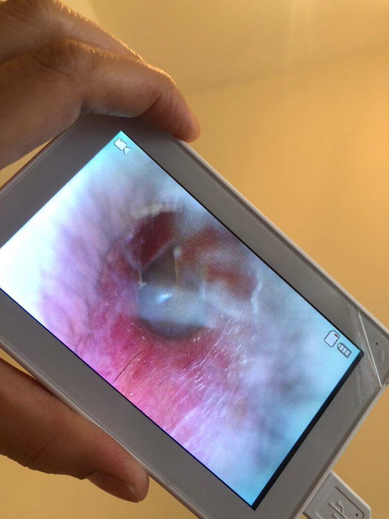 嘉義采耳推薦_Rose 葳耳