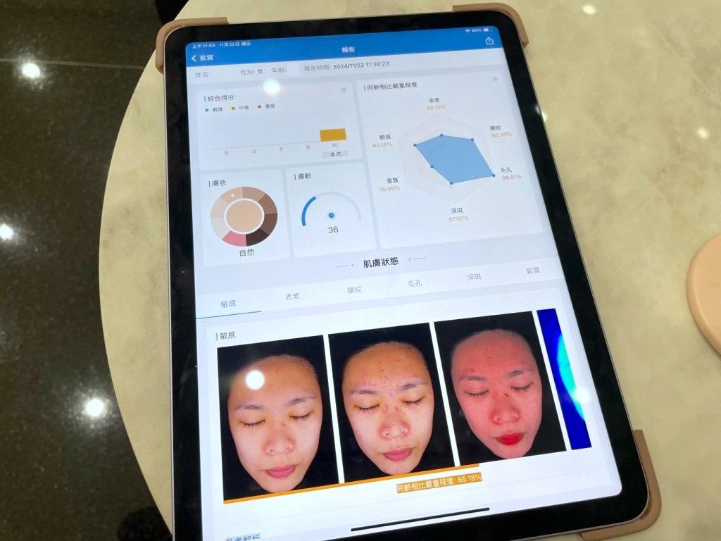 高雄皮秒雷射推薦 悅真醫美診所2