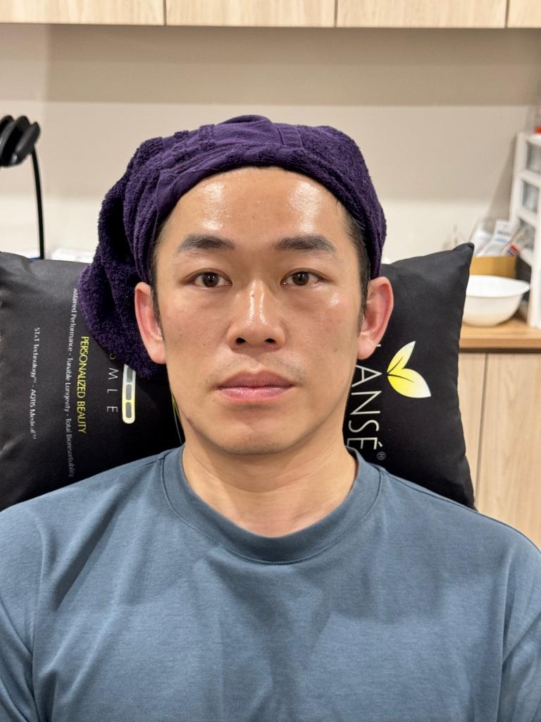 주사 시술 과정에서 통증은 없었습니다.