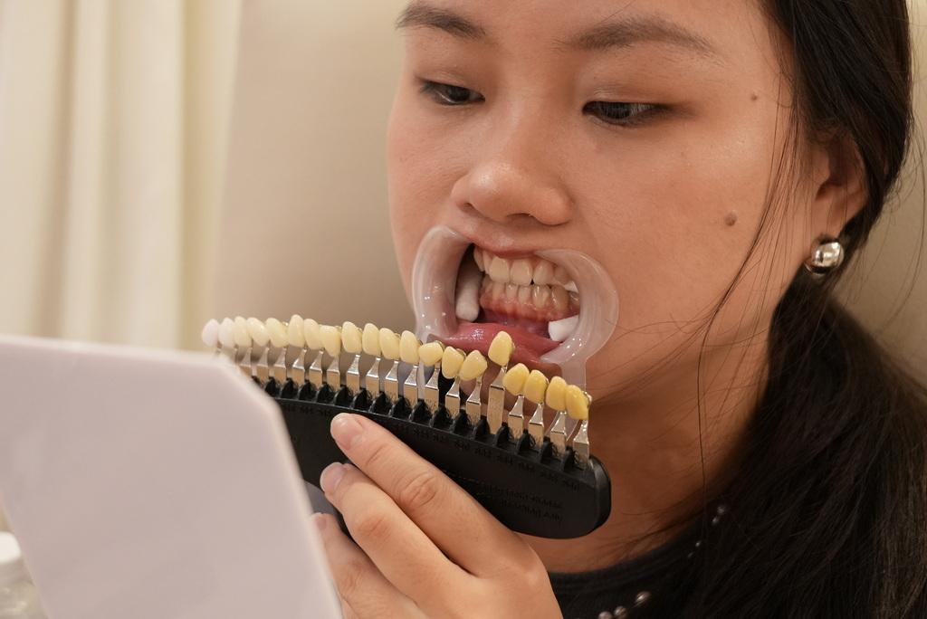 獨家免照光技術