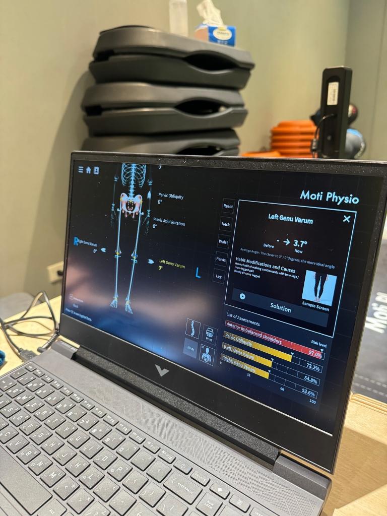 AIデバイス体験レビュー