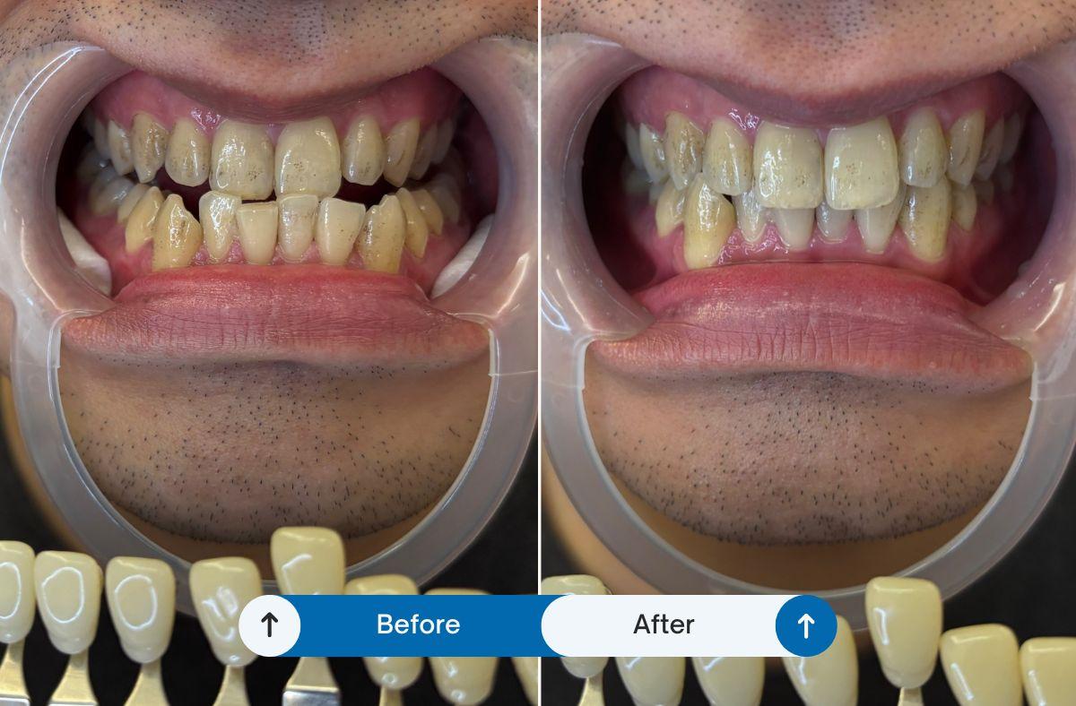 ATTRACTION DR. Whitening & Cosmetic Dentistry