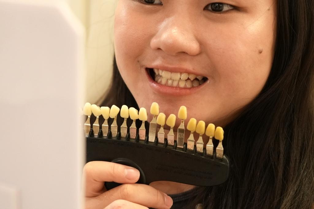 牙齒淨白範圍更廣且效果顯著