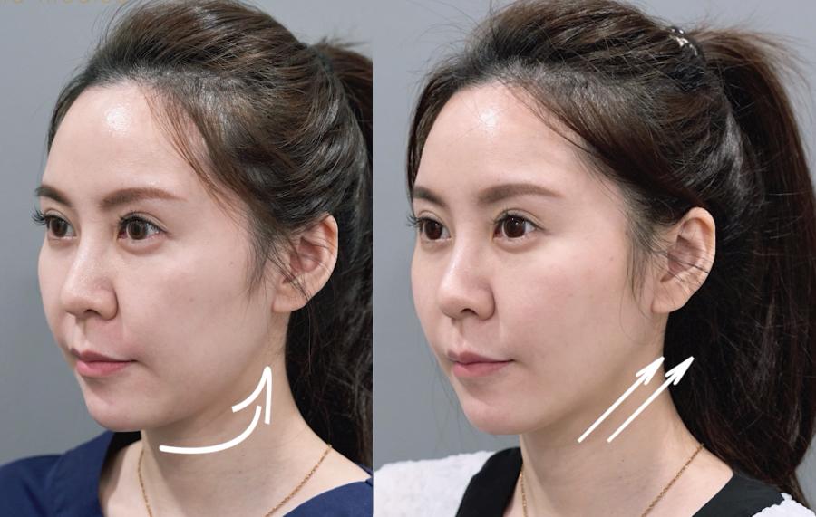 피부부터 윤곽까지 전반적인 개선