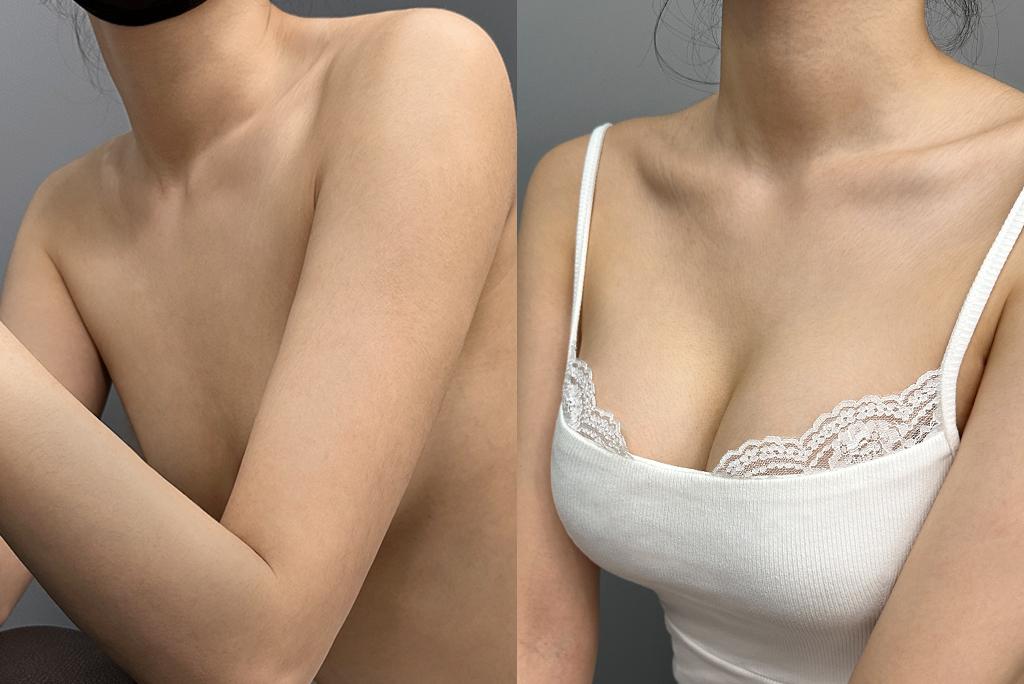 탄력 있는 윤곽과 자연스러운 아름다움 선사