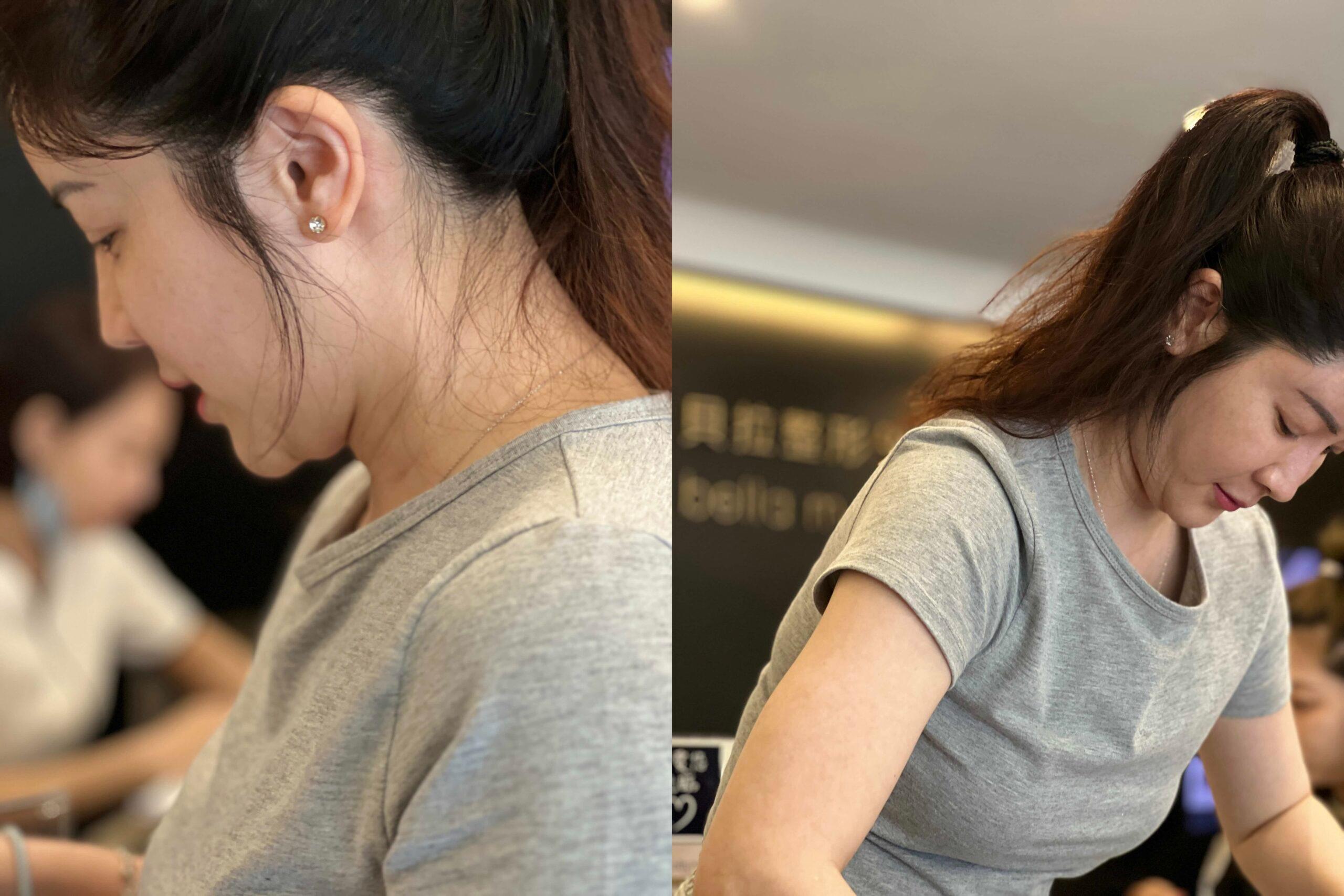 벨라 성형외과 의원 체험 후기