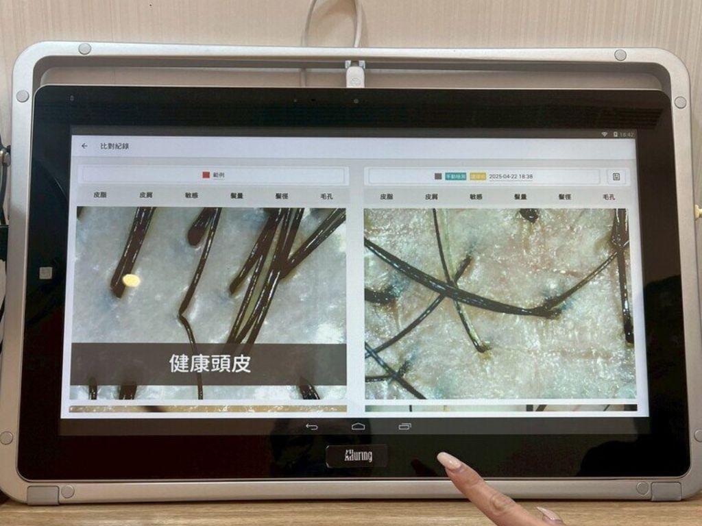 台北頭皮管理 DR CYJ髮胜肽健髮中心 05