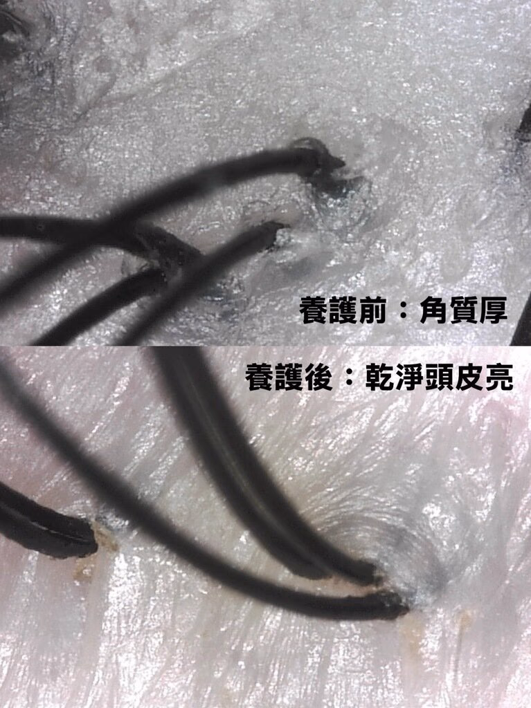 ๅฐไธญ็งๆ่ฒ้ซฎ_่ฑ่้ ญ็ฎ้ค่ญท_2025-10-21_4