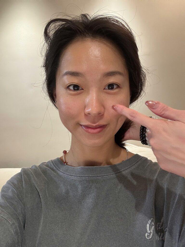 台北美顏針_太初中醫診所_2025-06-03_0