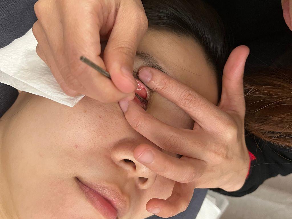 3단계 눈 피로 해소 마사지로 눈을 맑게 하세요