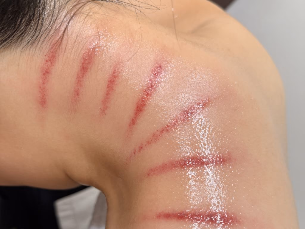 放鬆頭部與側頸的抓痧體驗