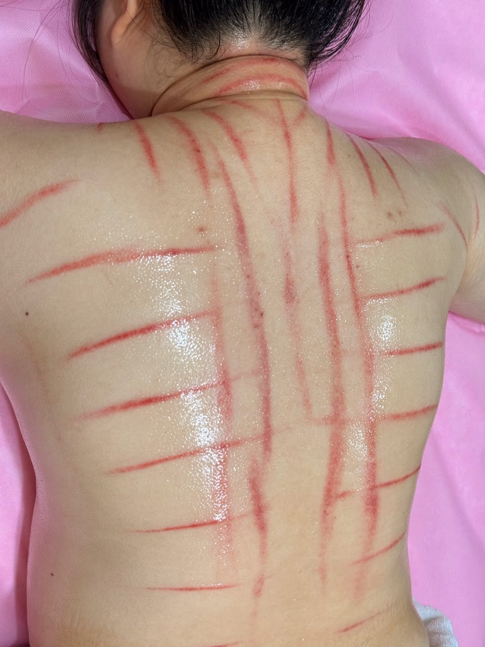 運動後的深層救贖:精準紓解重訓痠痛