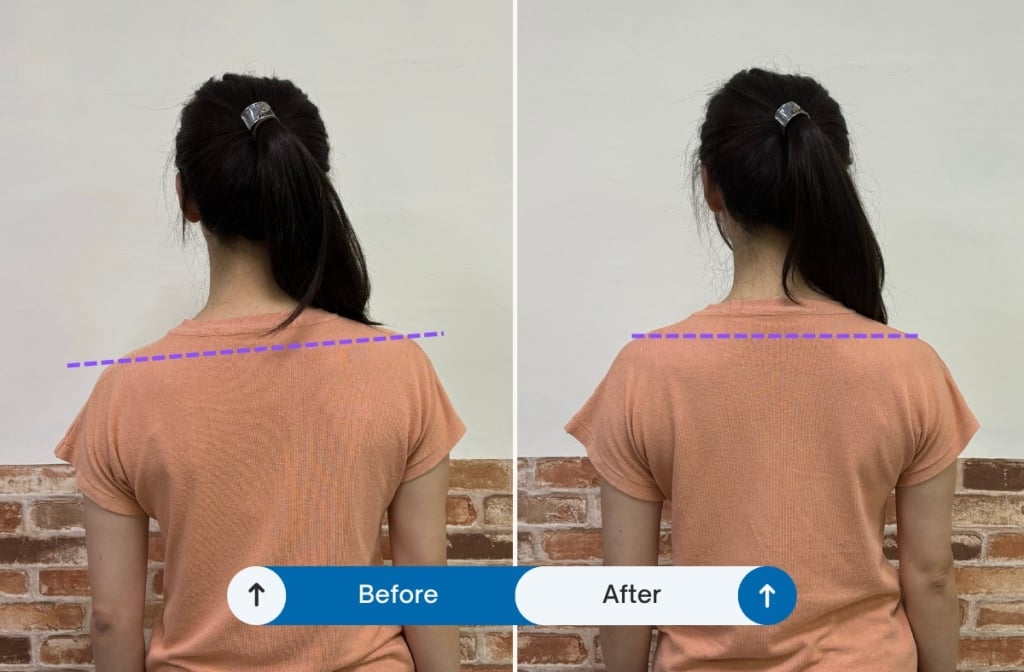 [Evaluation of Yili Traditional Orthopedic Massage Clinic] Physiotherapy background, traditional osteopathic integration into modern new technology 19