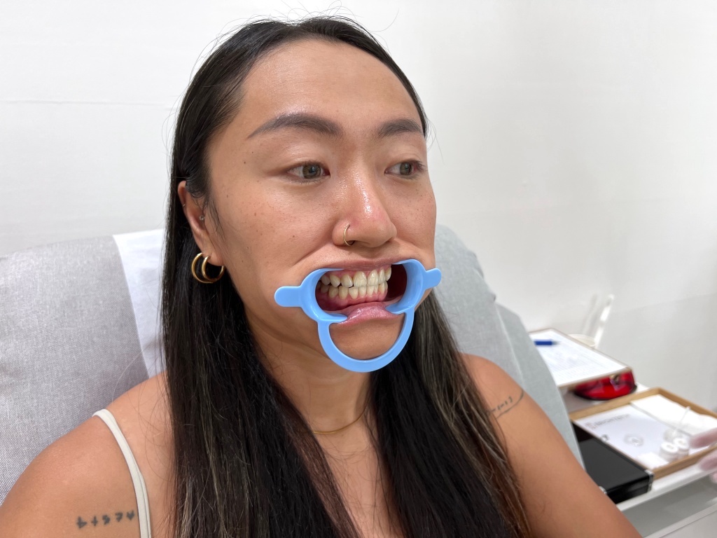 [Taichung BRIGHTEETH review] The dentist will take care of it for you! 40 minutes of red and blue light gives you double whitening 30
