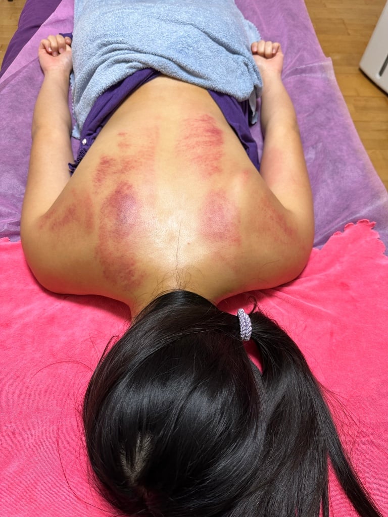 高雄運動按摩推薦-An•Mo-運動按摩2