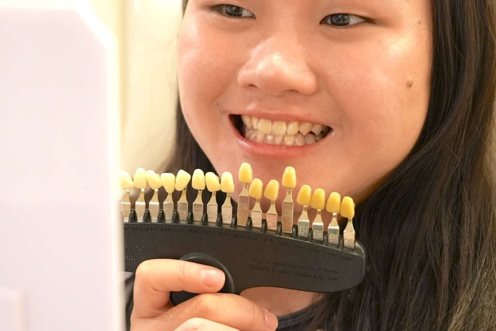 [치아미백센터 후기] 빛에 노출되지 않고도 미백이 가능해요! 민감한 치아를 위한 필수 방문 비체 치아미백샵 11