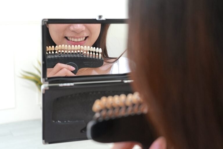 台北 歯のホワイトニング おすすめ BRIGHTEETH 歯のホワイトニング 審美センター4