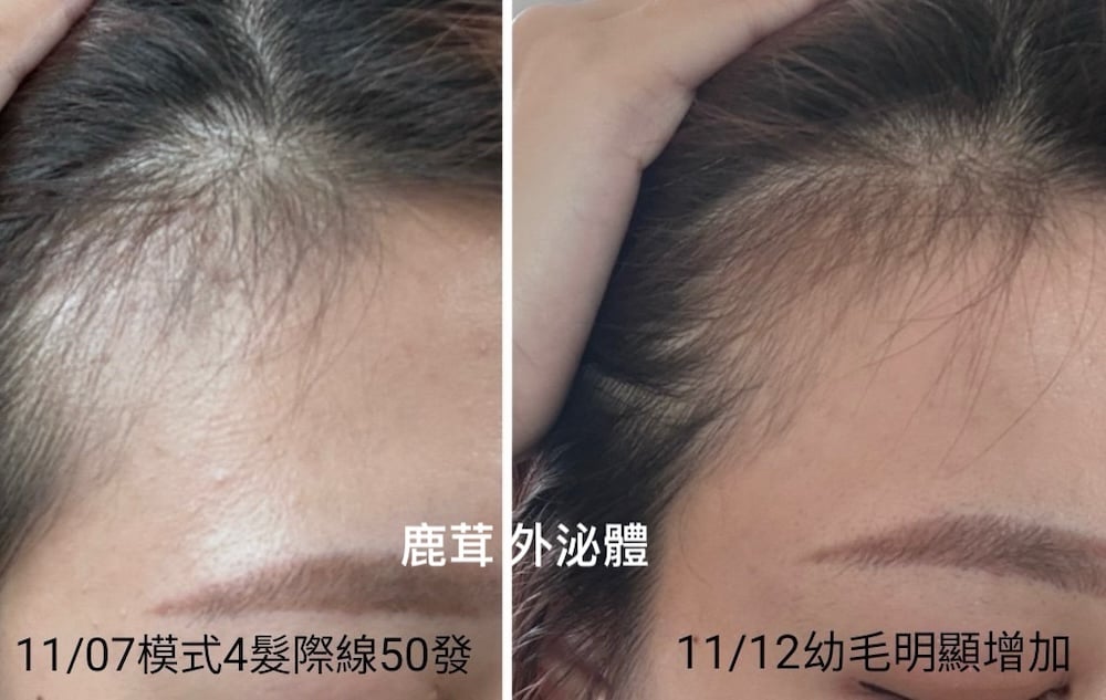 Hsinchu Scalp Care-S.-NO-Studio-6