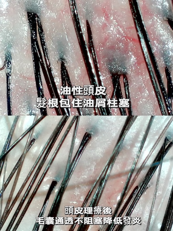 Hsinchu Scalp Care-S.-NO-Studio-7