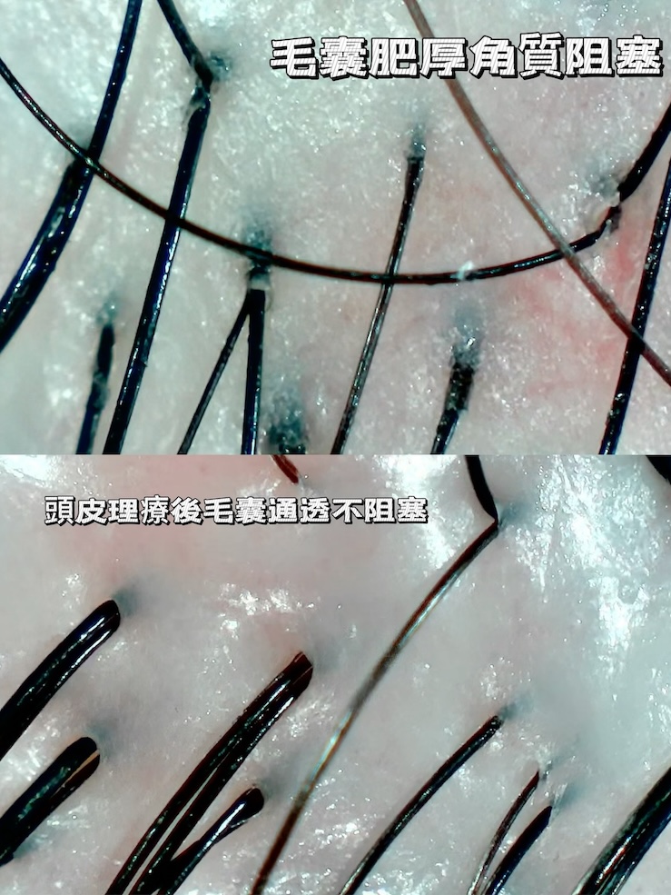 Hsinchu Scalp Care-S.-NO-Studio-8
