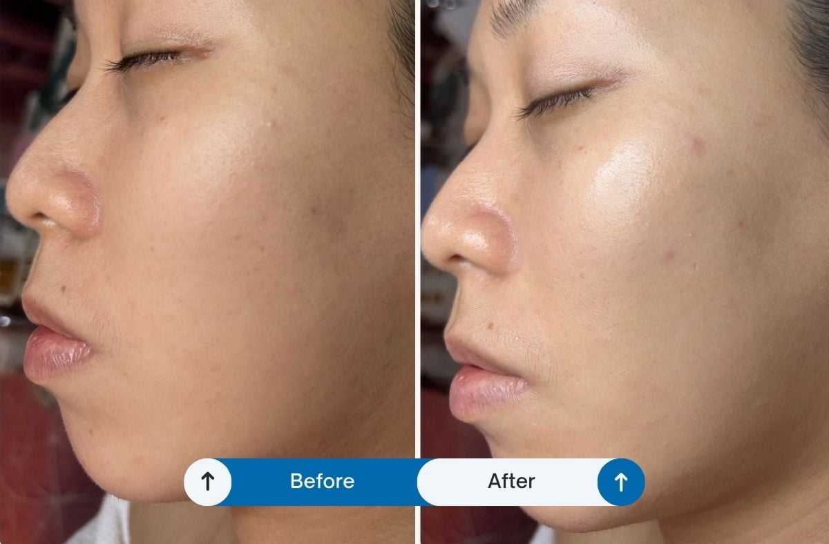 Taipei Facial Recommendation-Kuang Hsin-Yen Facial Aesthetics 4