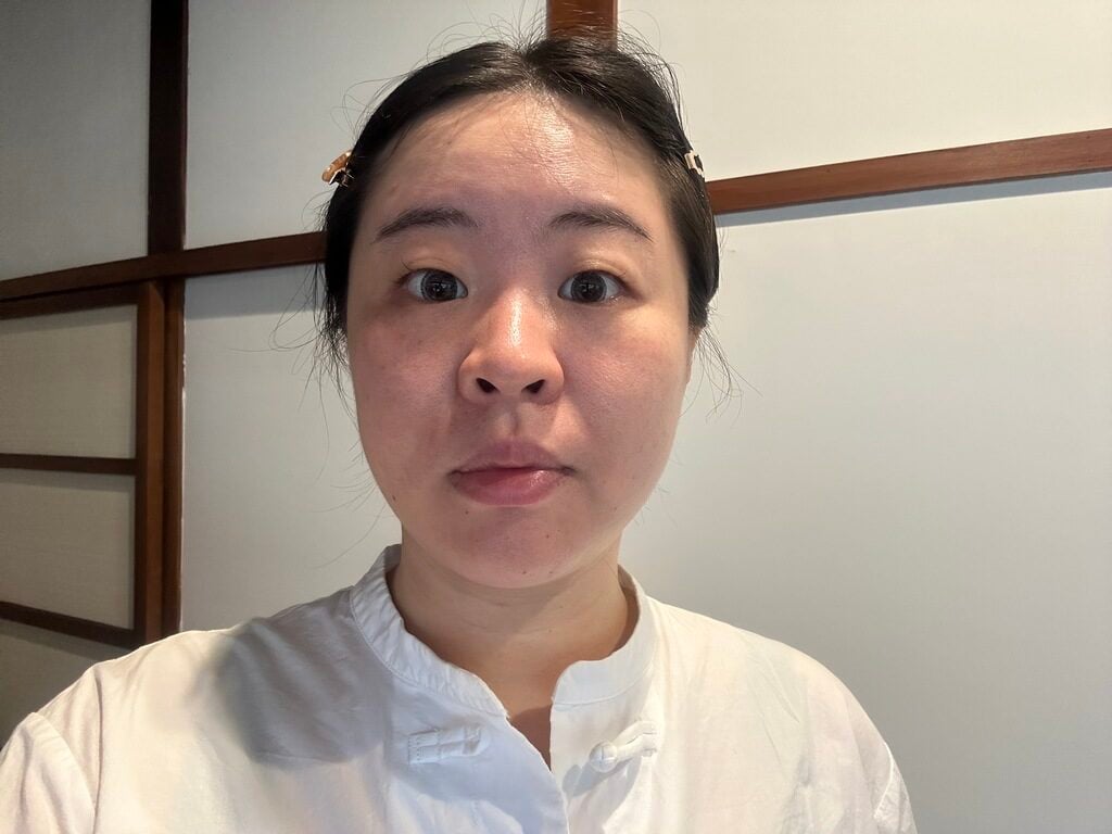 台南雷射皮秒 漾格爾皮膚科醫美診所 04