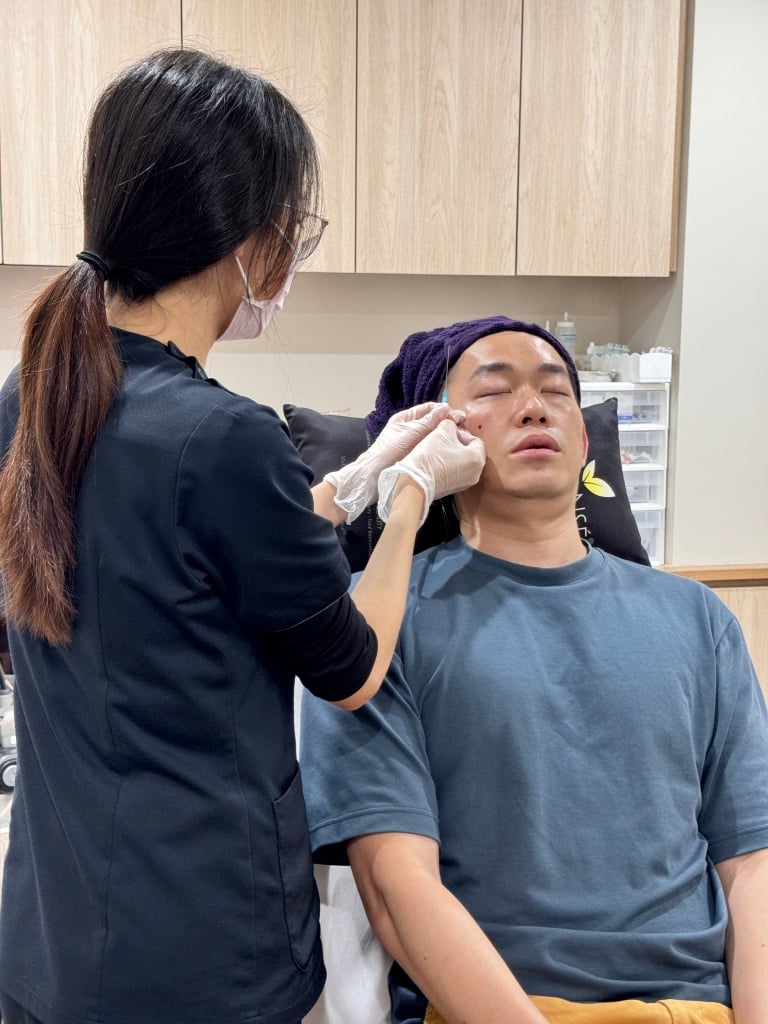 [Evaluation of Xu Huixiang Aesthetics Clinic] Nantun Medical Aesthetics Expert in eliminating eye bags! Never fails to fill the tear trough of Ji Liansi 14