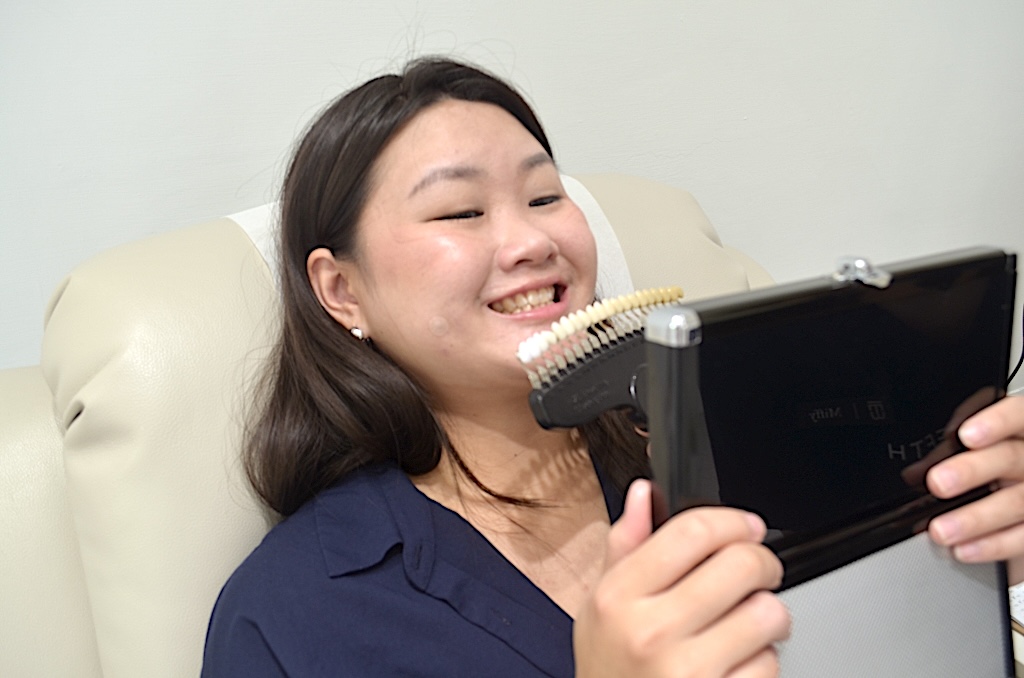 [BRIGHTEETH 신주점 리뷰] 치과의사의 혁신적인 케어로 치아를 원래의 하얀색으로 되돌릴 수 있다 31