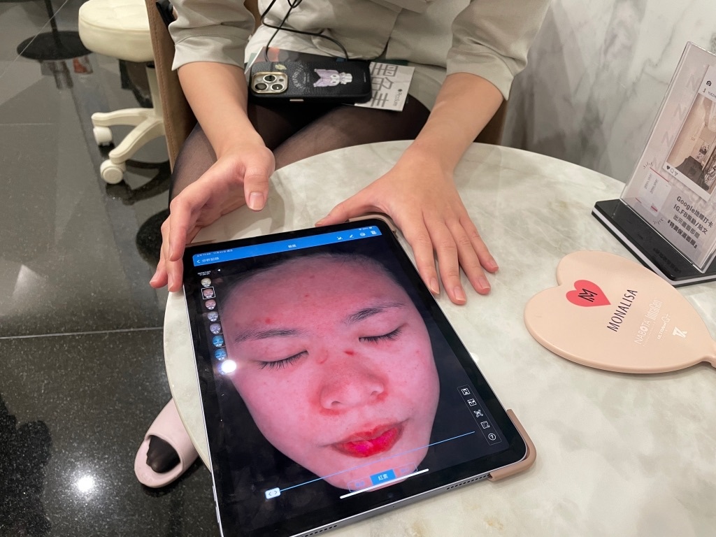 【岳鎮メディカルエステ口コミ】ボツリヌス毒素ピコ秒レーザーマスク、高雄メディカルエステ嬢をお手頃な料金で体験7
