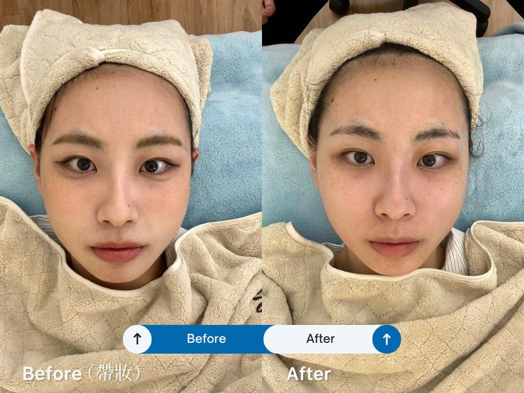 가오슝 페이셜 텐돈 마사지_청푸이슈알레아 프로페셔널 텐돈 마사지_BA
